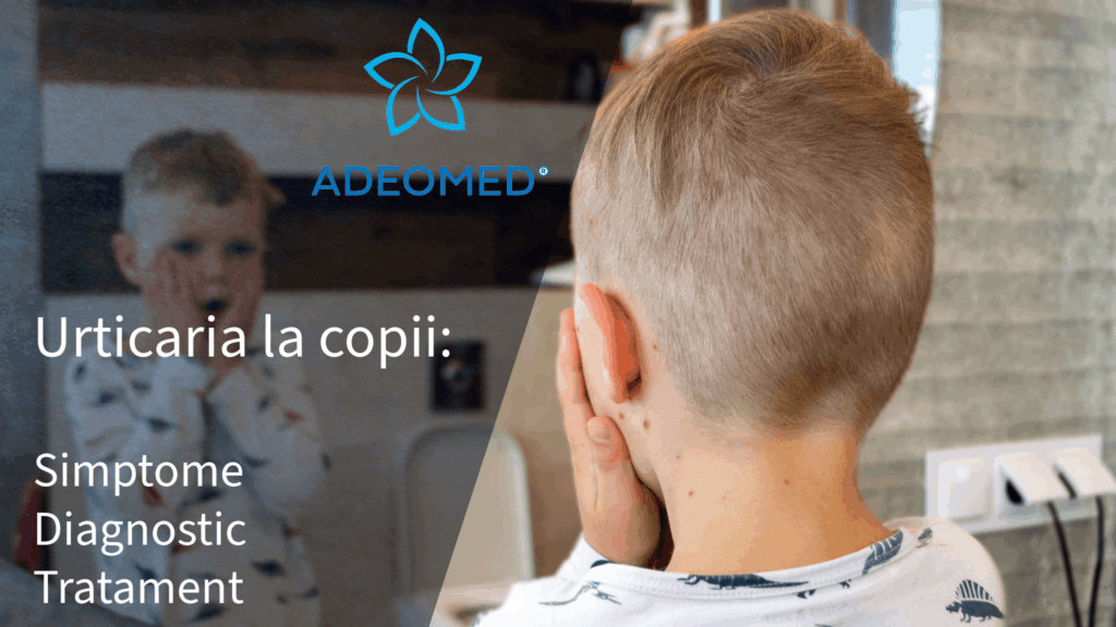 urticaria la copii