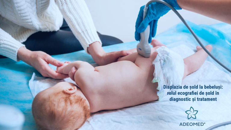 Displazia de șold la bebeluși: rolul ecografiei de șold în diagnostic și tratament