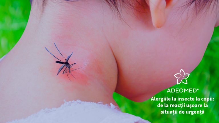 Alergiile la insecte la copii: de la reacții ușoare la situații de urgență